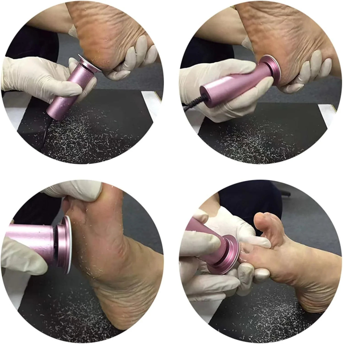 Electric Heel Remover for Healthy Feet