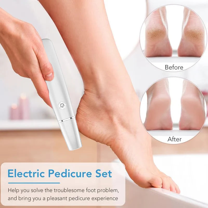 Electric Foot Care Device – SoleSmooth